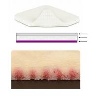 Mepilex XT Schaumverband 10 x 10 cm 5 St