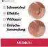 Medolin Warzenpflaster (22 Stk.)