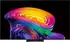 LG OLED83C67LA (83 Zoll)