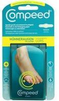 PZN-DE 07705502, Perrigo Compeed H&uuml;hneraugenpflaster Medium 10 St