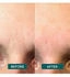 Apricot Facial Patches Niacinamide 