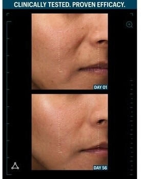Allies of Skin Multi Peptides & GF Advanced Lifting Serum 7 ml