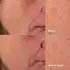 Clinique Even Better Clinical Dark Spot Clearing Serum