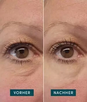 Apricot Wiederverwendbare Augen-Schläfen Pads mit Hexapeptid-Technologie