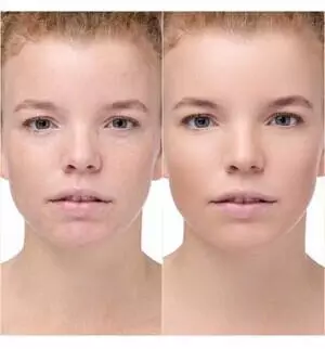 Catrice Instant Bright Serum Concealer (5ml) 020W