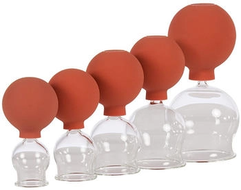 Sport-Tec Schröpfgläser mit Ball Set 5-teilig