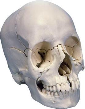 3B Scientific Steckschädel Anatomische Version 22-tlg A290