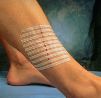3M Health Care Steri-Strip Wundverschlussstreifen, 12 x 100 mm (12 x 6 Streifen)
