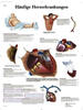 3B Scientific Lehrtafel - Häufige Herzerkrankungen