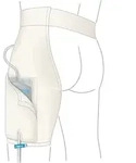 Uromed Einbeinhose, f&uuml;r Uromed Urinbeinbeutel, 1 St&uuml;ck XL