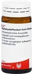 Epiphysis/plumbum Globuli