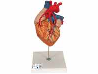 3B Scientific Menschliche Anatomie - Herz mit Bypass, 2-fache Größe, 4-teilig...