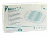 Tegaderm 3M Film 6.0cmx7.0cm 100 ST