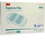 Tegaderm Film 10.0x12.0cm 50 ST