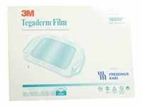 Tegaderm Film 10.0x12.0cm 5 ST