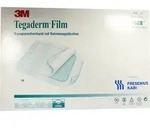 Tegaderm Film 15.0x20.0cm 10 ST