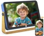 KODAK Digitaler Bilderrahmen mit Akku, WLAN Digitale Fotorahmen 10.1 Zoll | HD IPS