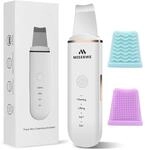 Skin Scrubber Face Skin Spatula Ultraschallpeelingger&auml;t Skin Scrubber