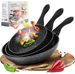 melianda IT-3000 3tlg Pfannenset 20cm - 24cm - 28cm antihaft Marmoroptik Elektro,