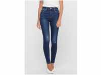 ONLY High-waist-Jeans Mila (1-tlg) Patches