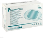 Solventum Germany GmbH Tegaderm 3M Film 6x7 cm 1624W 100 St 02097989_DBA
