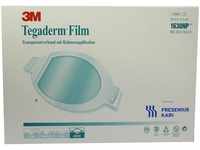 Fresenius Kabi Deutschland GmbH Tegaderm Film 10x11,5 cm oval 1630Np 5 St