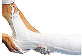 Lohmann & Rauscher Cellona Gipsbinden 12 cm x 4 m (2 x 5 Stk.)