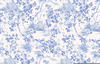 Komar Charming Bloom blau/weiß 300 x 280 cm