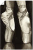 Artland Wandbild »Balletschuhe II«, Sport, (1 St.), als Leinwandbild, Poster...