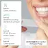 Uniquesmile Whitening Strips (40 Stk.)