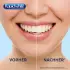 Rapid White Bleaching Strips (6 Sachets)